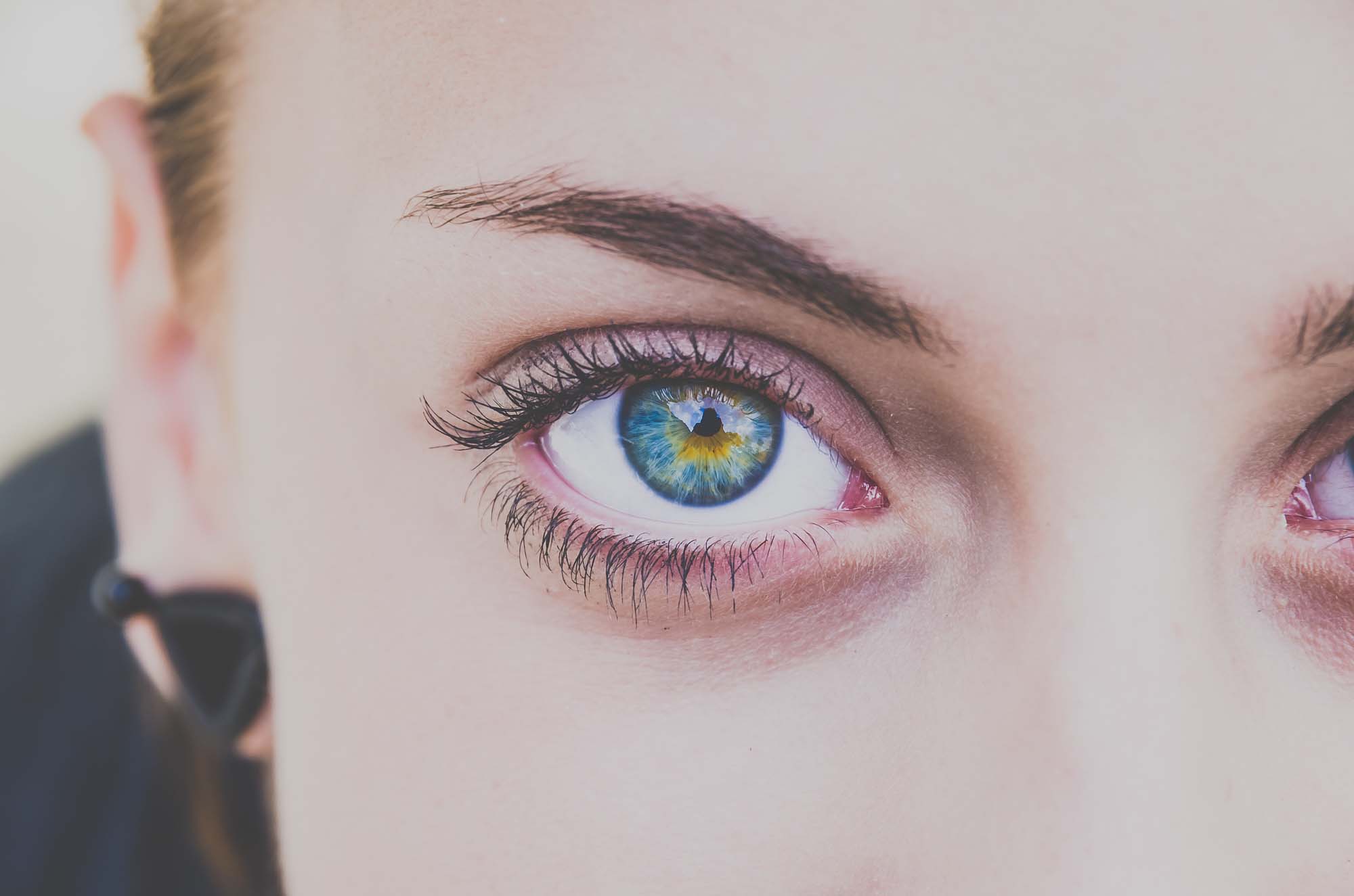 Iridology||